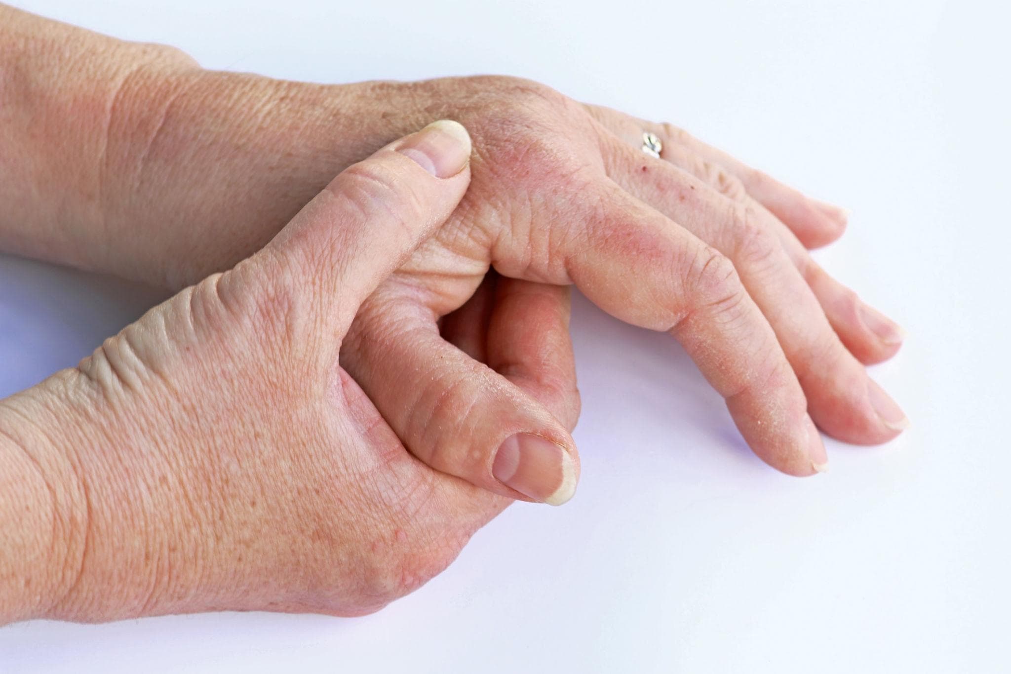 Signs of Arthritis: Early Symptoms, Causes and Treatment Options