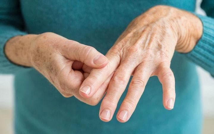 Signs of Arthritis in Hands